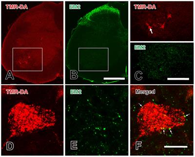 Endomorphin-2 Decreases Excitatory Synaptic Transmission in the Spinal Ventral Horn of the Rat